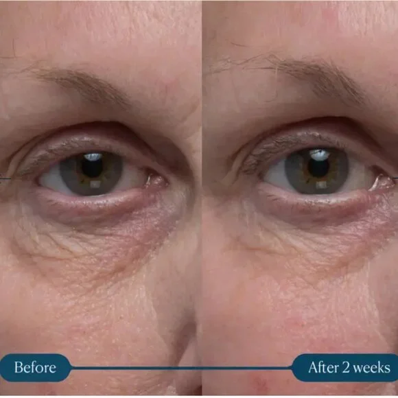 ELEMIS Pro-Collagen Vitality Eye Cream NIB Factory Sealed! - Picture 4 of 12